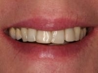 Konig Center for Cosmetic & Comprehensive Dentistry smile photos
